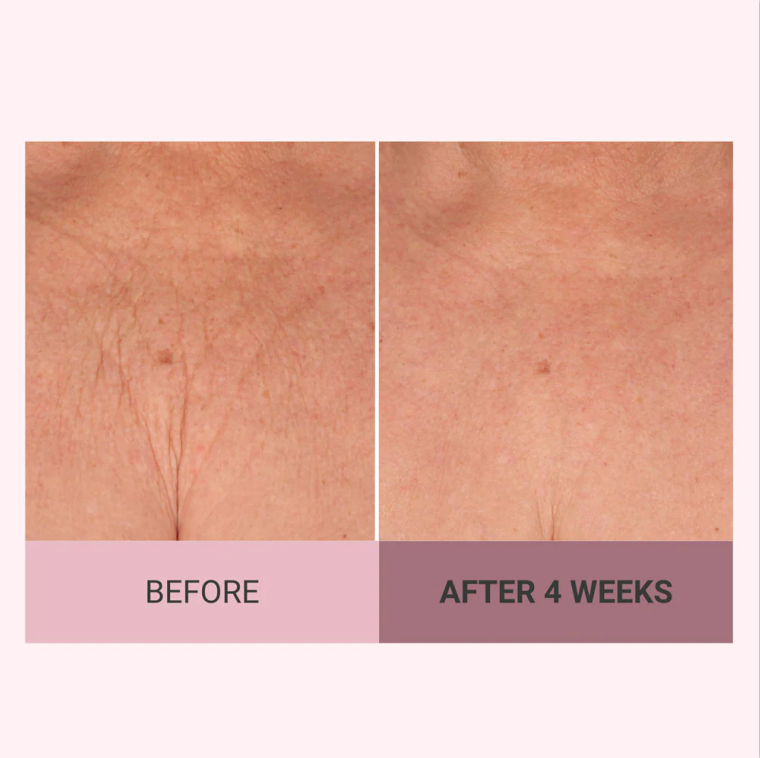 Experience Ultimate Luxury - 50% OFF - ✨ Champagne Beaute Lift Firming Body Crème - For Firmer, Smoother, Radiant Skin! 🌟