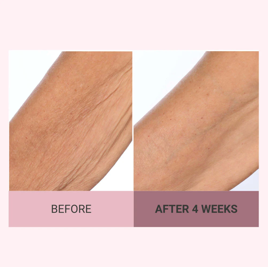 Experience Ultimate Luxury - 50% OFF - ✨ Champagne Beaute Lift Firming Body Crème - For Firmer, Smoother, Radiant Skin! 🌟
