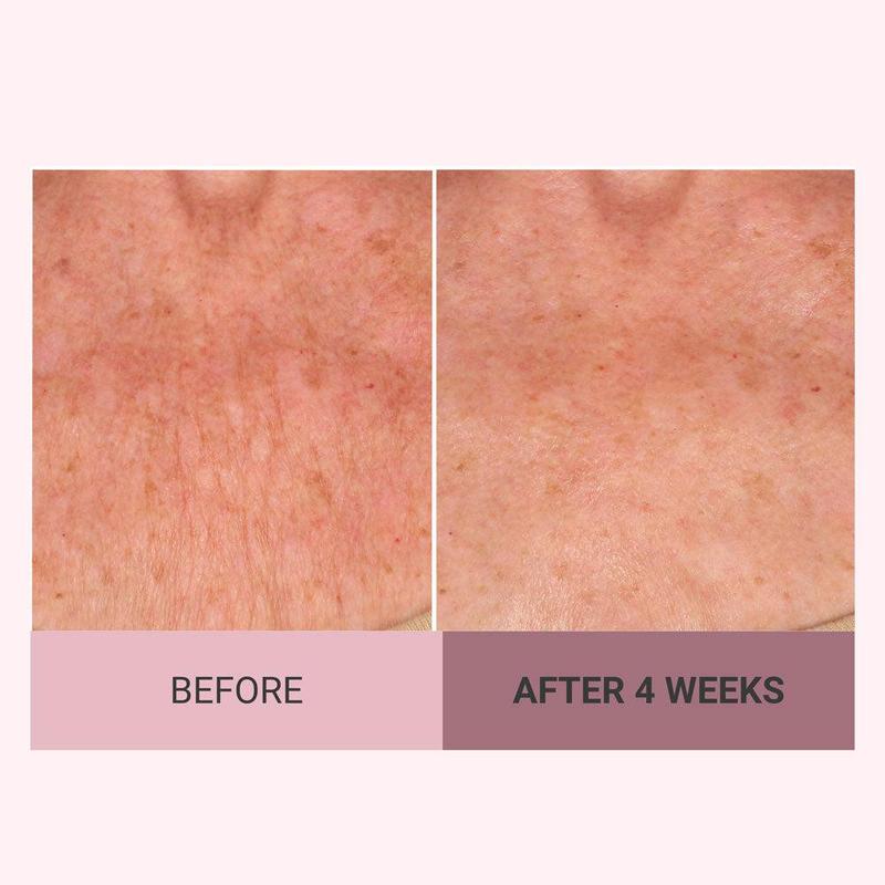 Experience Ultimate Luxury - 50% OFF - ✨ Champagne Beaute Lift Firming Body Crème - For Firmer, Smoother, Radiant Skin! 🌟