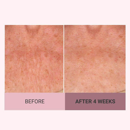 Experience Ultimate Luxury - 50% OFF - ✨ Champagne Beaute Lift Firming Body Crème - For Firmer, Smoother, Radiant Skin! 🌟
