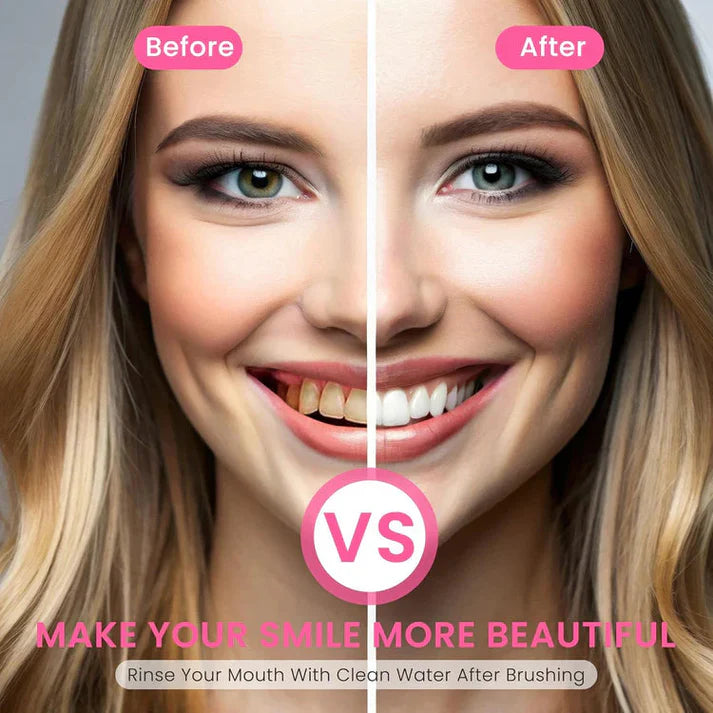 💗Final - 3 Hours: 60% OFF Nicotinamide Whitening Toothpaste