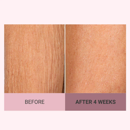 Experience Ultimate Luxury - 50% OFF - ✨ Champagne Beaute Lift Firming Body Crème - For Firmer, Smoother, Radiant Skin! 🌟